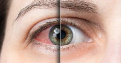 Desprendimiento de retina qué es, causas y cómo evitarlo