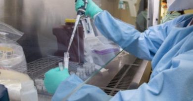 Escasez de reactivos para las pruebas afecta laboratorios