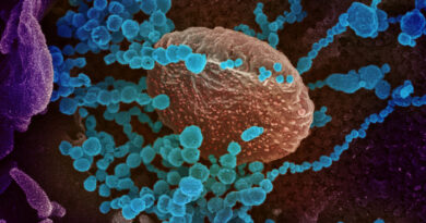 Científicos revelan "una de las cosas más extrañas del nuevo coronavirus"