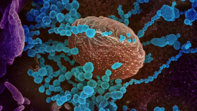 Científicos revelan "una de las cosas más extrañas del nuevo coronavirus"