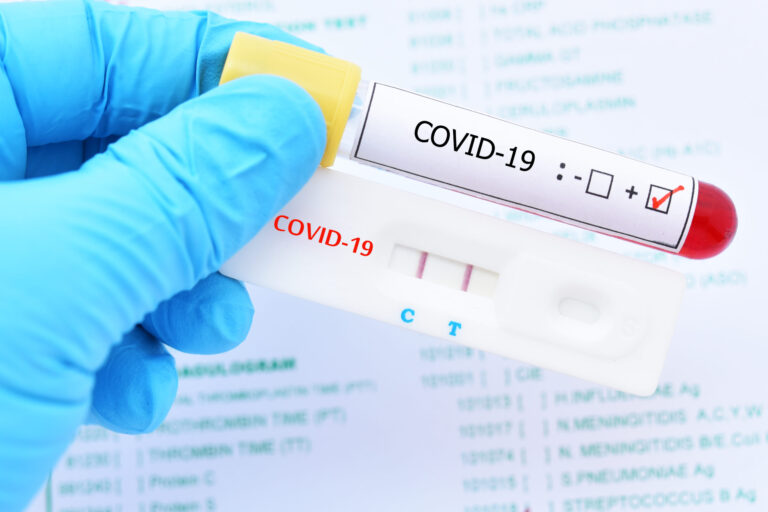 Pruebas PCR permanecen suspendidas en hospitales de Santo Domingo
