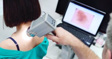 Dermatoscopia: ¿qué es y para qué sirve?