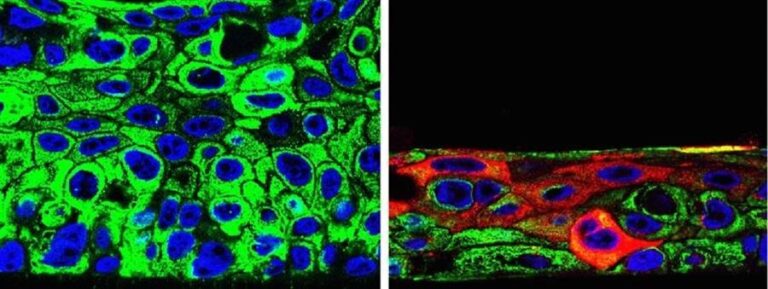 Identifican moléculas clave para la malignidad del cáncer de cabeza