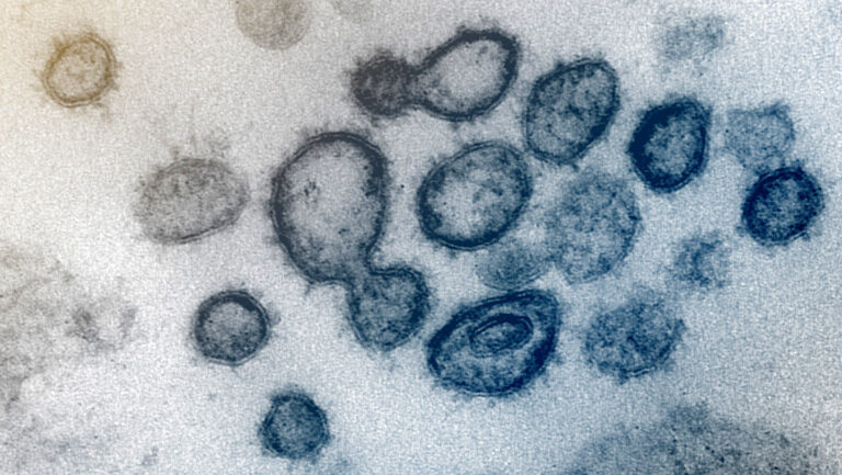 Nuevas imágenes revelan en detalle cómo infecta el coronavirus las