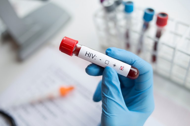 Identificaron una cepa de VIH resistente a todos los antivirales del tratamiento actual
