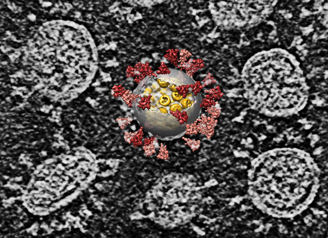 Imágenes detalladas de la estructura del SARS-CoV-2 ayudaron a entender cómo el virus ataca a las células