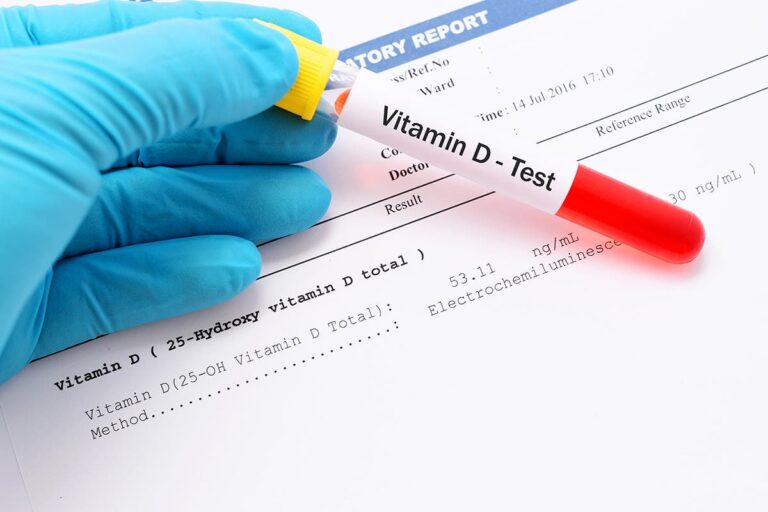El 82% de pacientes con covid-19 tiene falta de vitamina