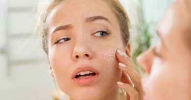 ¿Cuáles son las causas de la piel seca?