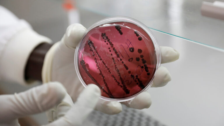 ALERTA ARENAVIRUS :Un nuevo virus letal similar al Ébola y que se contagia de persona a persona prende las alertas tras un brote en Bolivia 