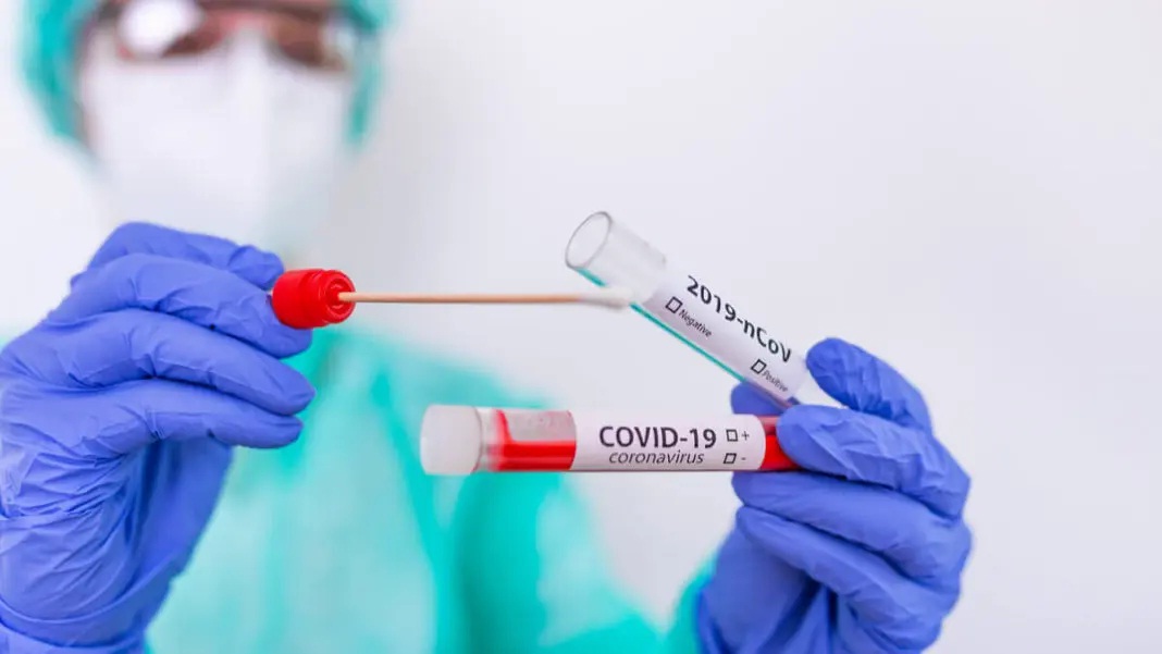 Coronavirus RD: 2 muertes y 671 casos positivos notificados en últimas horas