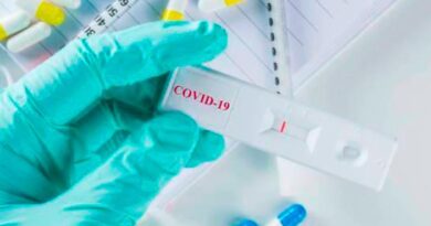 Laboratorios privados tienen insumos para suplir demanda de pruebas de COVID-19