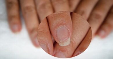 ¿Cuáles son los suplementos naturales para las uñas?