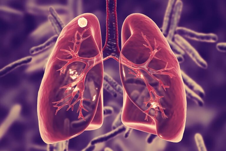 Día Mundial de la Tuberculosis: "el reloj no se detiene"