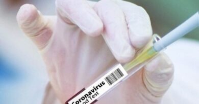 Coronavirus RD: Tres fallecimientos y 623 casos nuevos