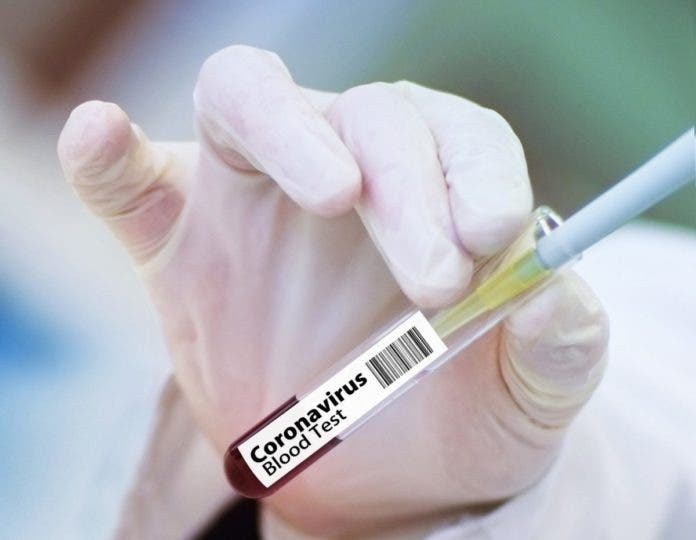 Coronavirus RD: Tres fallecimientos y 623 casos nuevos
