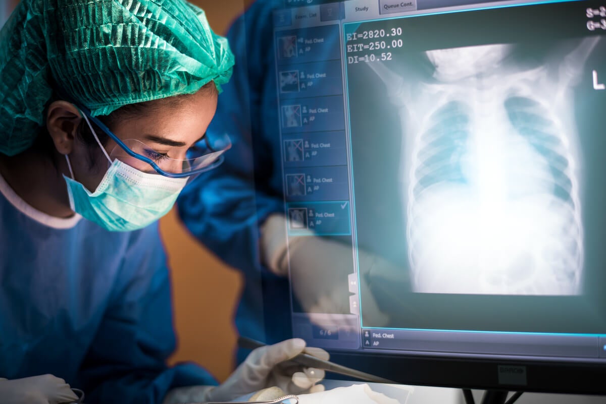 ¿Cómo se realizó el estudio sobre la lesión pulmonar asociada al vapeo?
