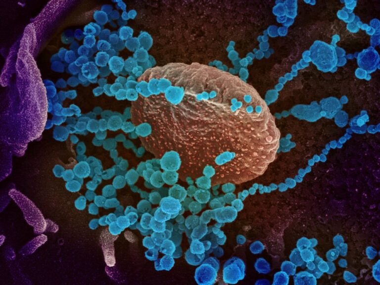 Hallan una nueva forma de transmisión del COVID-19, lo que daría pistas de cómo combatir al virus