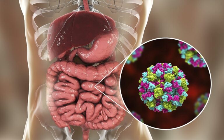 Razones por las cuales puedes sufrir de gastroenteritis