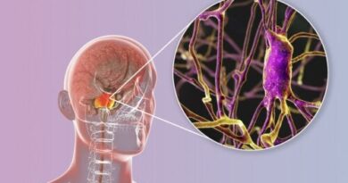 Linfoma del sistema nervioso central: ¿qué debes saber?