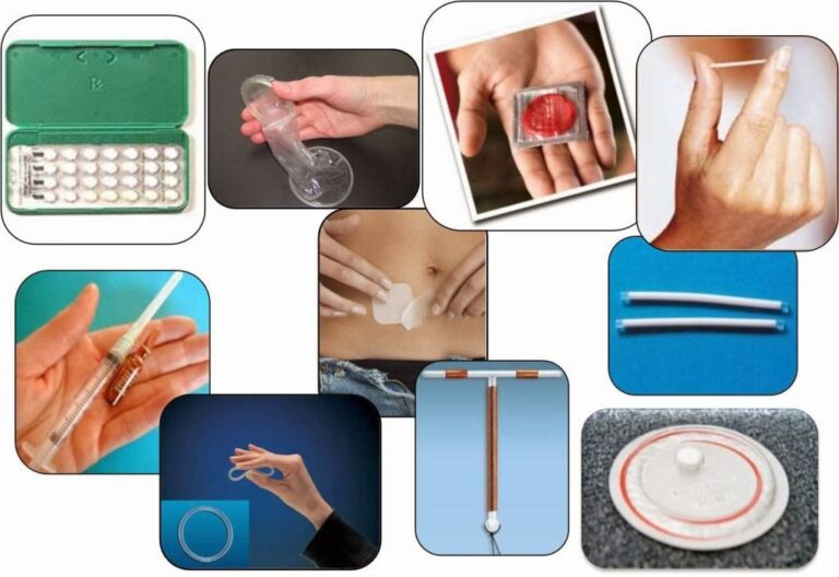 Tipos de métodos anticonceptivos y efectividad