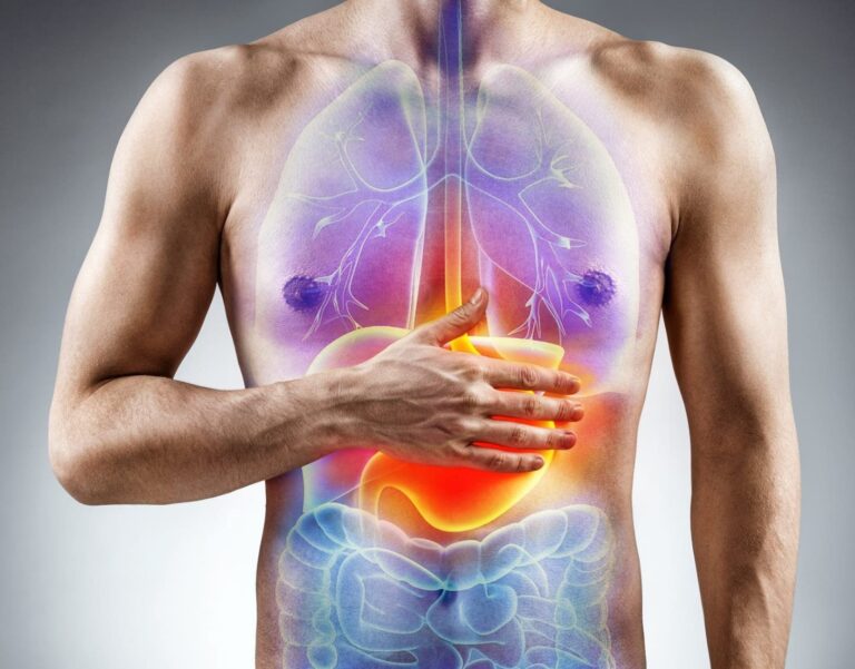 Reflujo gastroesofágico afecta más a los hombres
