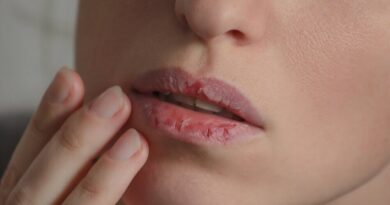 ¿Qué significan los cambios de color en los labios?