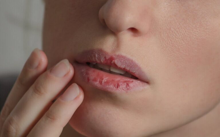 ¿Qué significan los cambios de color en los labios?