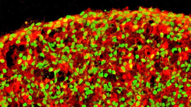 Un paso más hacia una posible solución para la diabetes