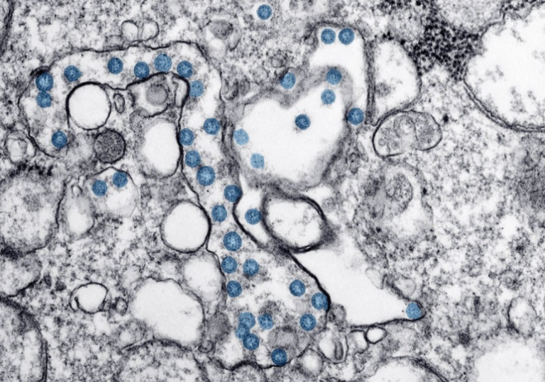 Experto advierte que la sífilis y otras dos infecciones están