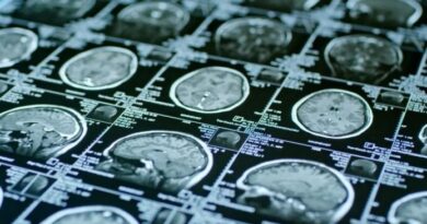 Los casos leves de COVID-19 también podrían acelerar el envejecimiento cerebral