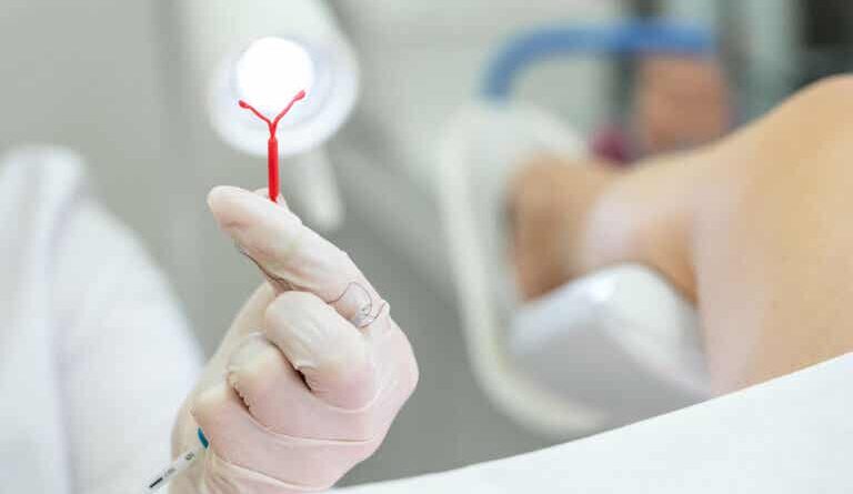 Dispositivo intrauterino: ¿qué es y para qué sirve?