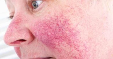 Enfermedades comunes en la piel y cómo tratarlas