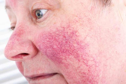 Enfermedades comunes en la piel y cómo tratarlas