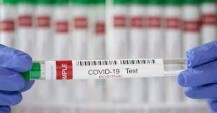 ¿El COVID-19 nunca dejará de estar entre nosotros? Qué pasó con otras enfermedades infecciosas en la historia