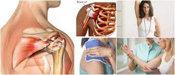 Posibles causas del dolor en el brazo derecho