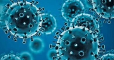 Coronavirus RD: 63 contagios y 301 casos activos 