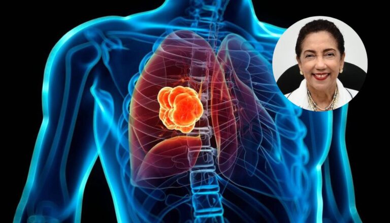 Costos tratamiento, deducibles y copagos barreras para tratar cáncer de pulmón