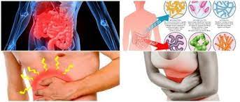Enteritis: qué es, causas, síntomas y tratamiento