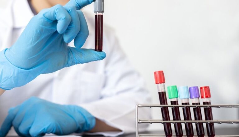Explican cómo la hepatitis E engaña al sistema inmune