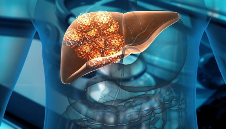 Identifican los mecanismos por los cuales NOX4 actúa como freno molecular del cáncer de hígado