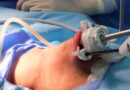 El oncológico implementa nueva técnica para cirugía