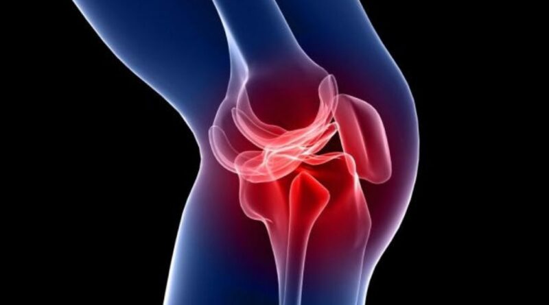 ¿Qué diferencias existen entre artritis reumatoide y psoriásica?