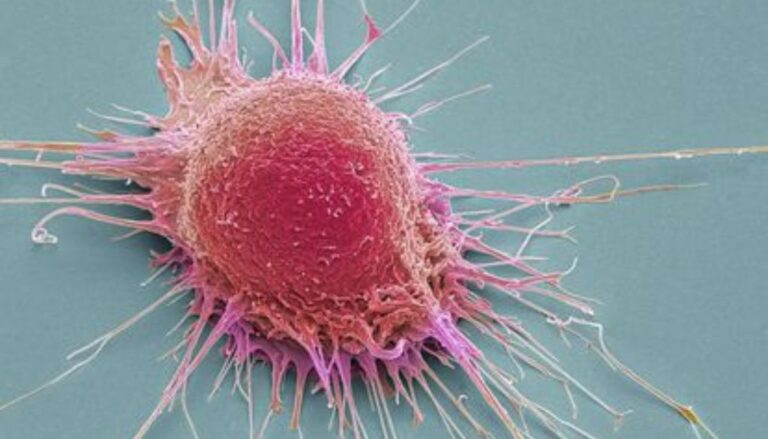 Así avanza el fármaco español pionero en su estrategia contra el cáncer