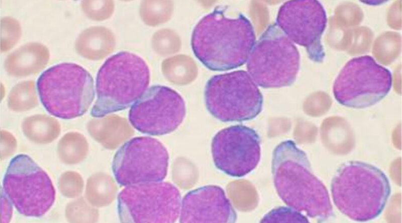 Descubren rol de proteína clave en el desarrollo leucemia mielogénica crónica