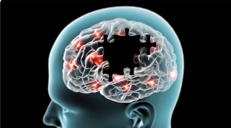 Nuevo paso para diagnóstico del Alzheimer en práctica clínica diaria