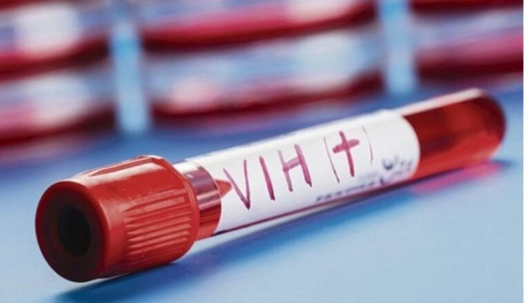 Hospital Luis L. Bogaert recibe un equipo para pruebas carga viral VIH y VPH