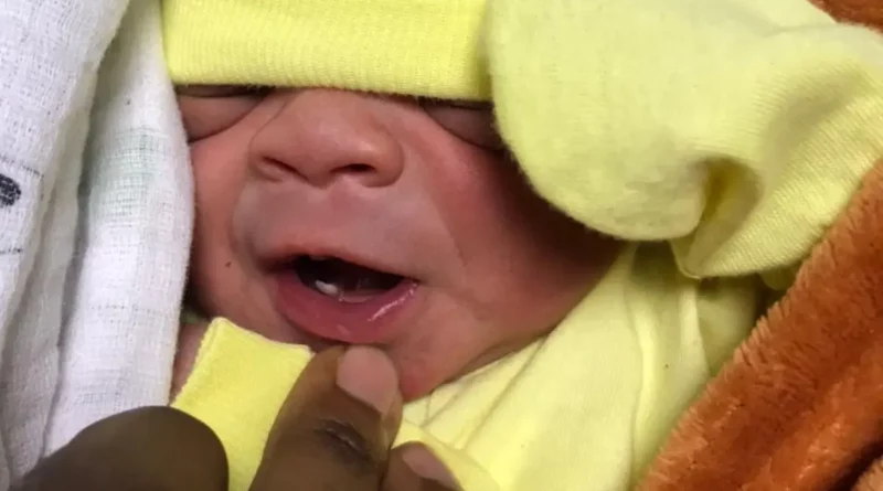ATENCION: Nace niño con un diente en hospital de Cotuí