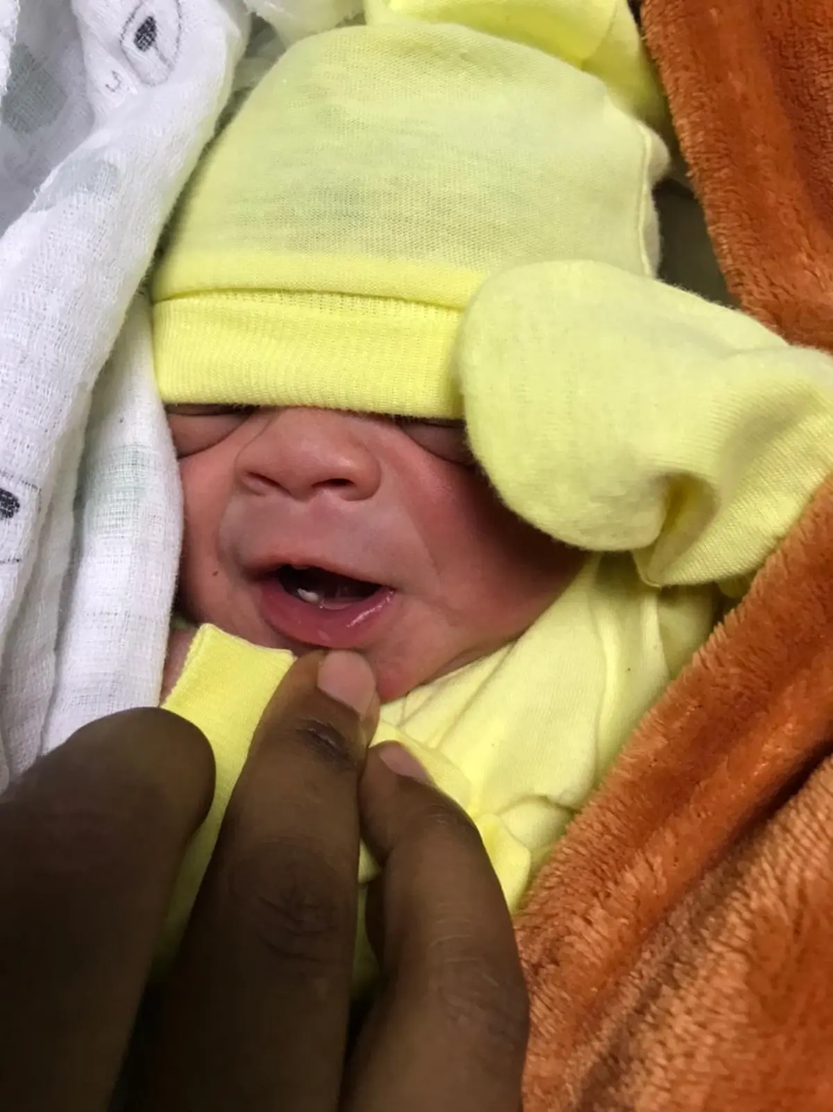 ATENCION: Nace niño con un diente en hospital de Cotuí