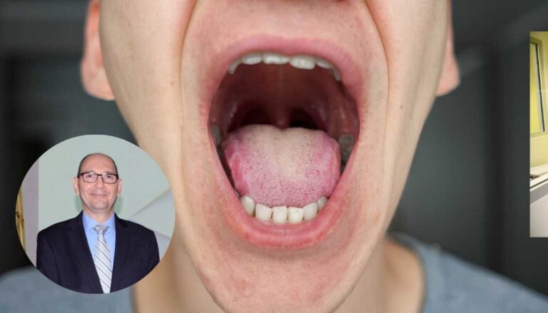 Cáncer bucal afecta alrededor 4% población del país