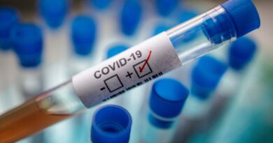 Reportan 17 nuevos casos de covid-19 que sigue a la baja en el país